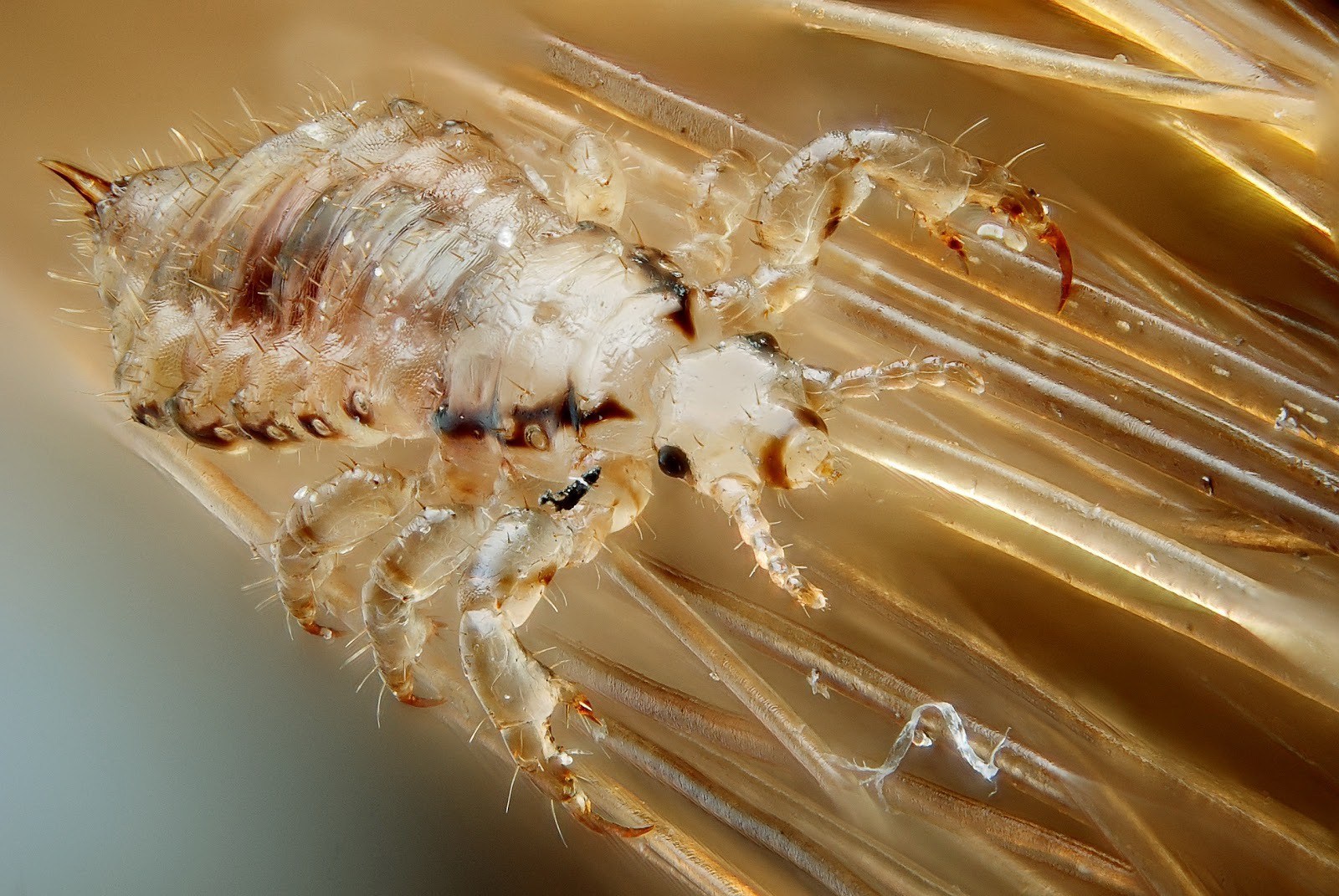 Crab Louse - Hình ảnh minh họa